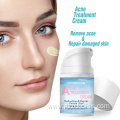 best pimple acne cream for face